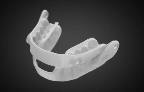 orthese avancee mandibulaire